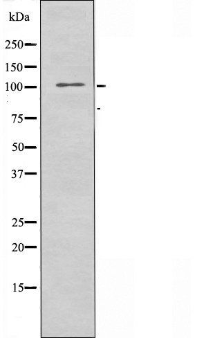 NCAPG antibody
