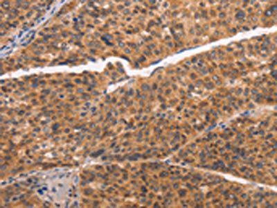 NCAPG2 Antibody