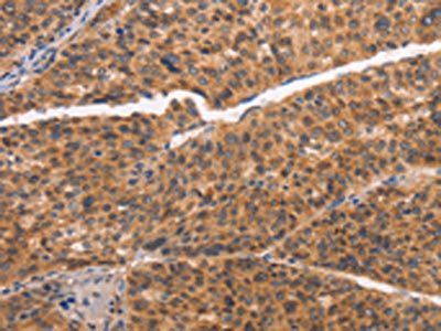 NCAPG2 antibody