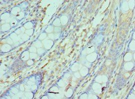 NCBP2 antibody