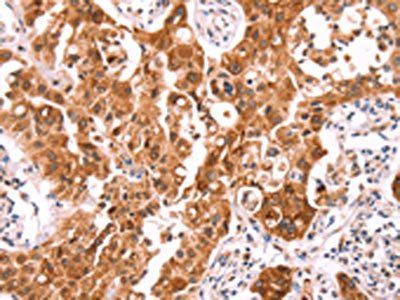 NCEH1 antibody