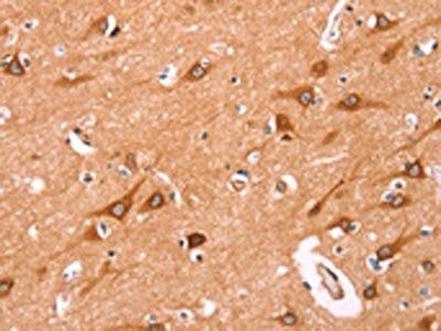 NCEH1 Antibody