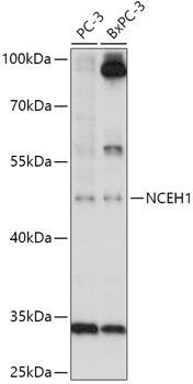 NCEH1 antibody