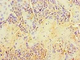 NCK2 Antibody