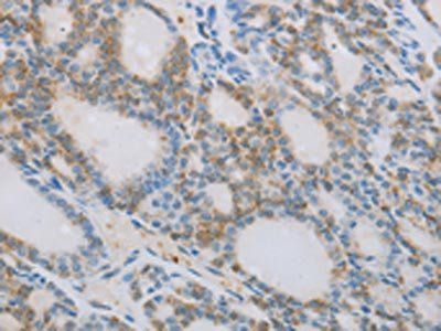 NCK2 Antibody