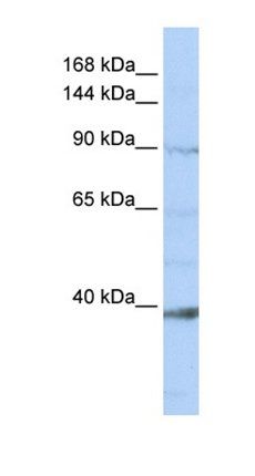 NCKAP1L antibody