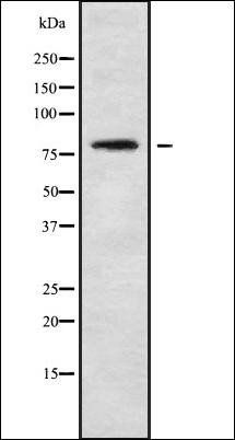 NCKIPSD antibody
