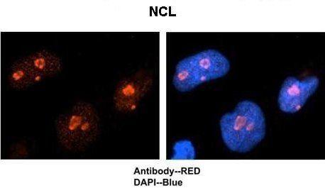 NCL antibody