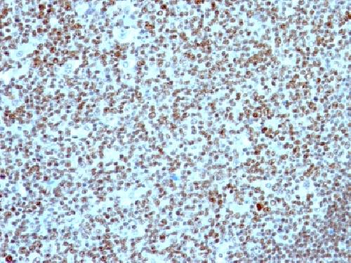 NCL antibody