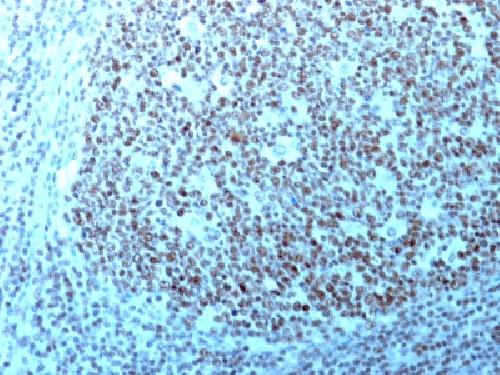 Nucleolin (Marker of Human Cells) Antibody