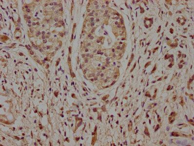 NCLN Antibody