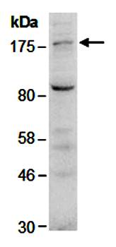 NCOA1 antibody