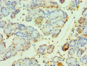 NCOA4 Antibody