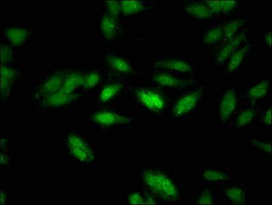 NCOR1 Antibody