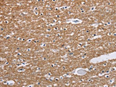 NCR2 Antibody