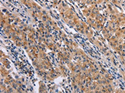 NCR2 Antibody