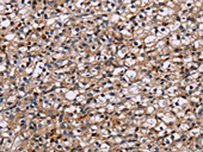 NCSTN Antibody