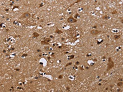 NCSTN Antibody