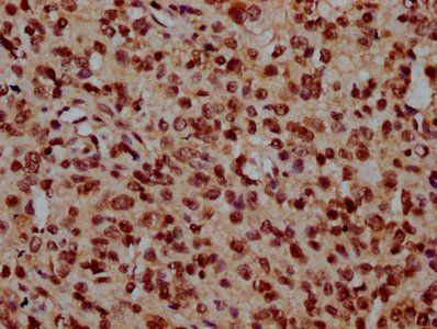 NDC1 Antibody