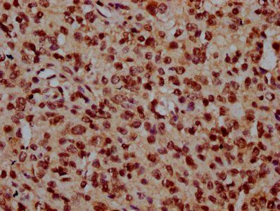 NDC1 antibody