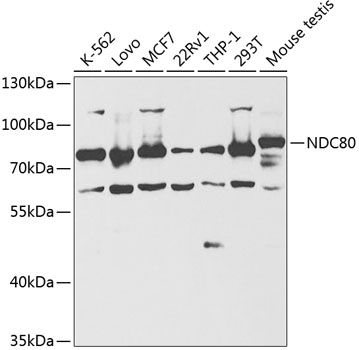 NDC80 antibody