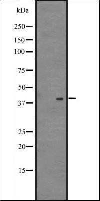 NDFIP2 antibody
