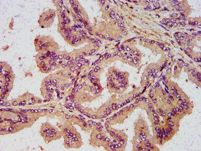 NDN Antibody