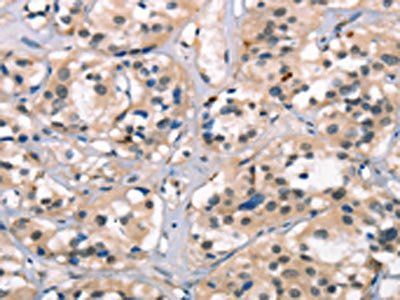 NDNL2 antibody