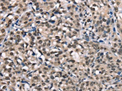 NDNL2 Antibody
