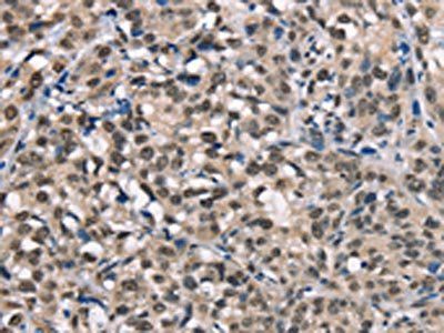 NDNL2 antibody