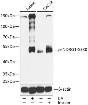 NDRG1 (Phospho-S330) antibody