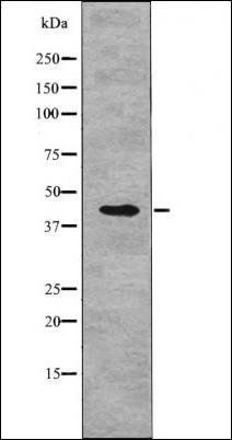 NDRG1 (Phospho-Ser330) antibody