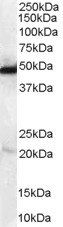 Goat anti-NDRG1 Antibody