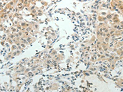 NDRG2 antibody