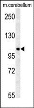 NDST2 antibody