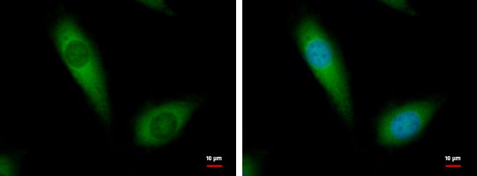 NDUFA10 Rabbit Polyclonal Antibody