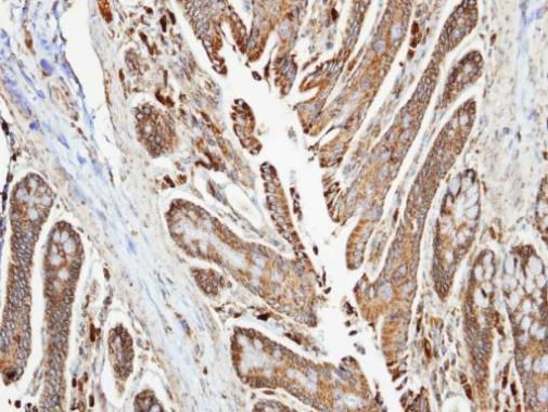 NDUFA10 Rabbit Polyclonal Antibody