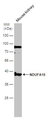 NDUFA10 Rabbit Polyclonal Antibody