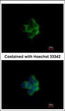 NDUFA10 Rabbit Polyclonal Antibody