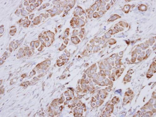 NDUFA10 Rabbit Polyclonal Antibody