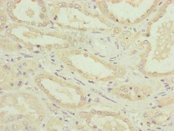 NDUFA12 antibody