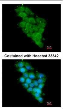 NDUFA12 antibody [N1C3]