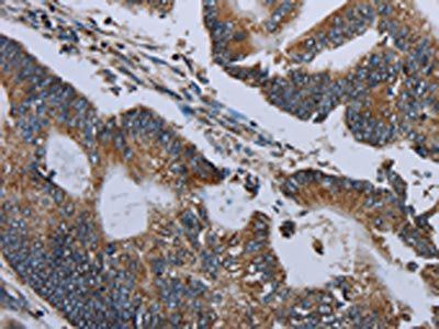 NDUFA13 Antibody