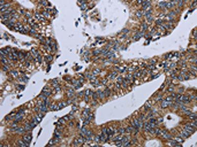 NDUFA13 Antibody