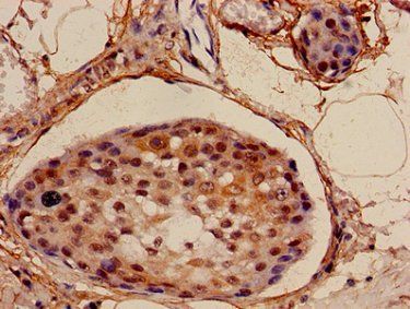 NDUFA4L2 Antibody
