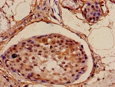 NDUFA4L2 antibody