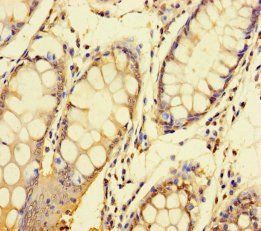 NDUFAF1 Antibody