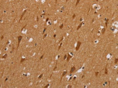 NDUFAF1 Antibody