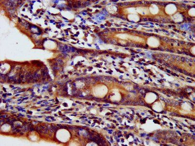 NDUFAF2 Antibody