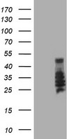 NDUFAF7 Antibody